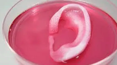 future-ear-reconstruction Future ear reconstruction