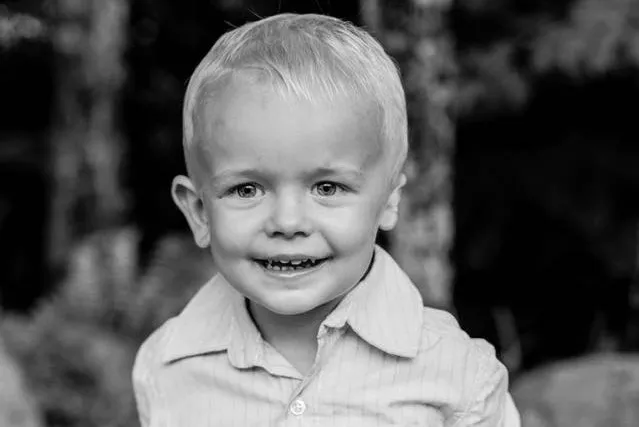 mictrotia-treatment-baby Black and white photo of boy with microtia