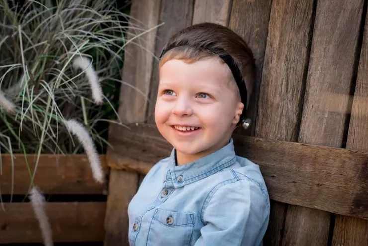 Toddler with microtia