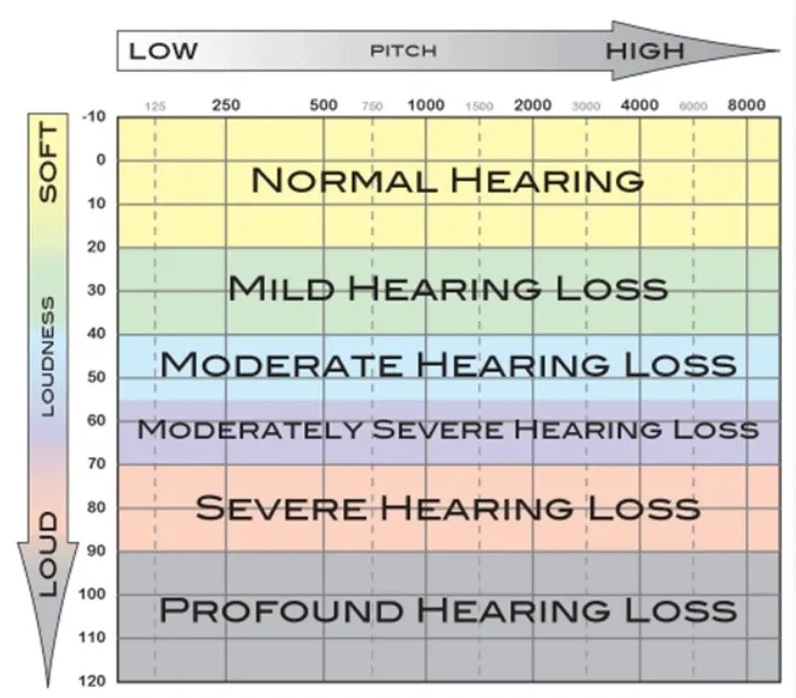 audiogram Audiogram graph explanation