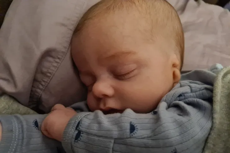 baby-with-hearing-loss Baby with hearing loss