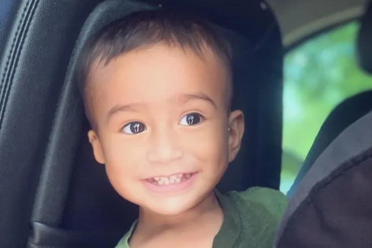 green-shirt-boy Cheeky boy with microtia smiling