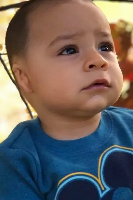 microtia-boy-blue-shirt Boy with microtia in blue shirt