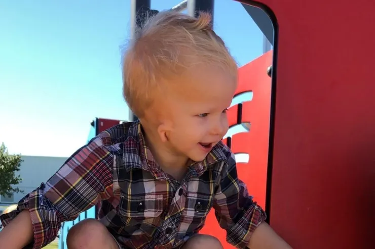 Smiling boy with microtia