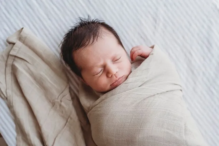 Newborn baby with microtia and atresia