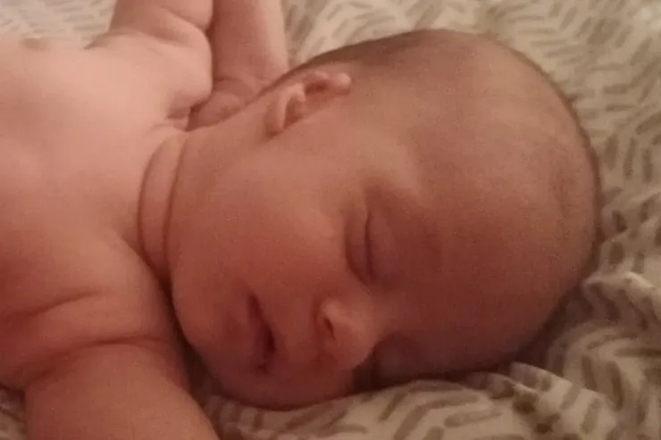 sleeping-baby Baby with microtia asleep on bed