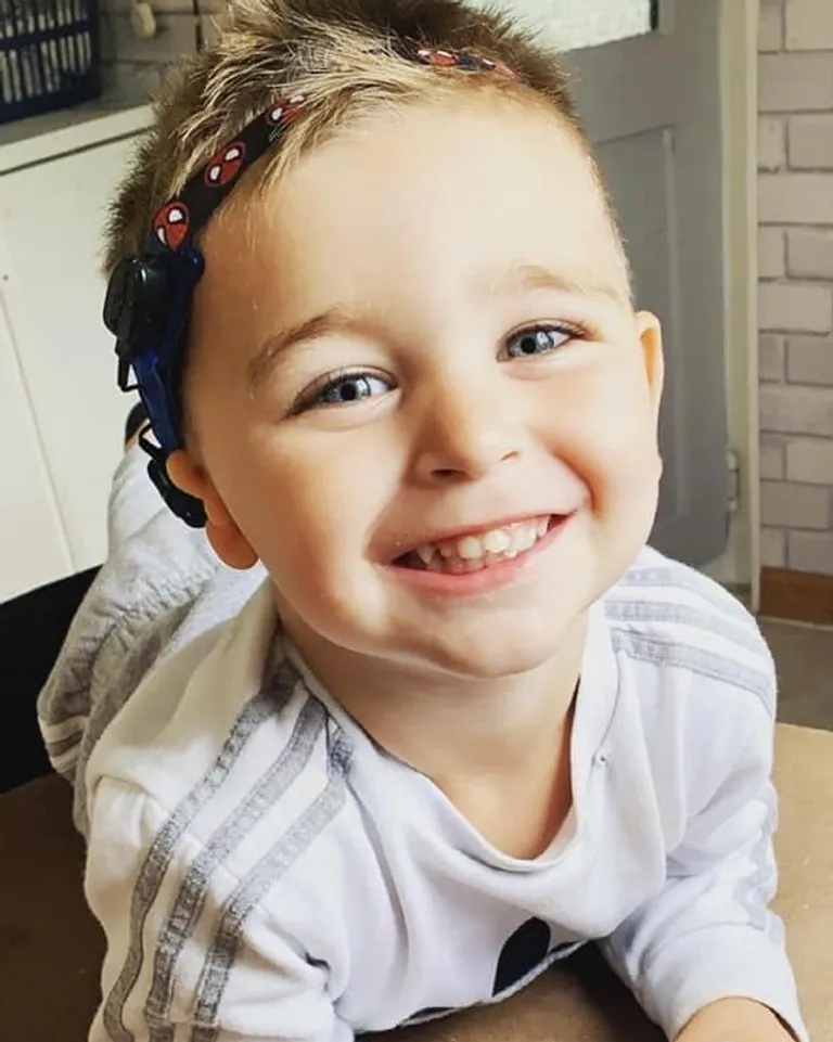 unilateral-hearing-loss-tips Close up photo of a young boy wearing a hearing device