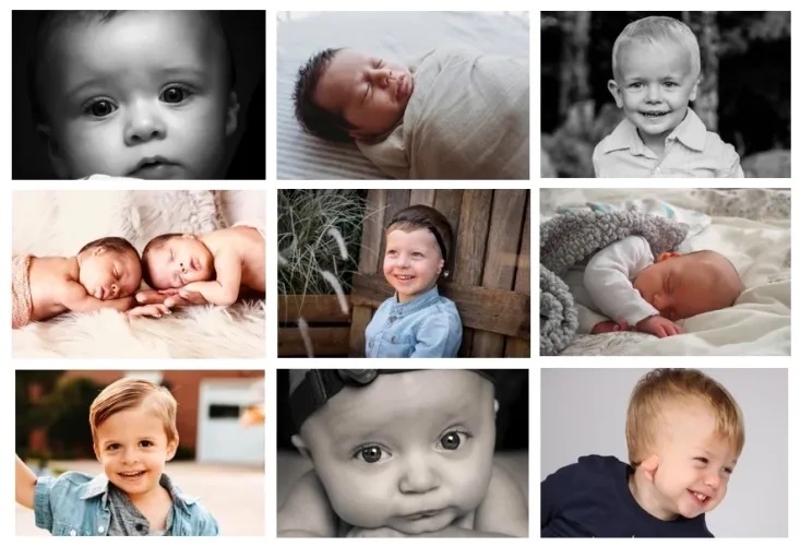 microtia-atresia Grid of images of children with microtia and atresia